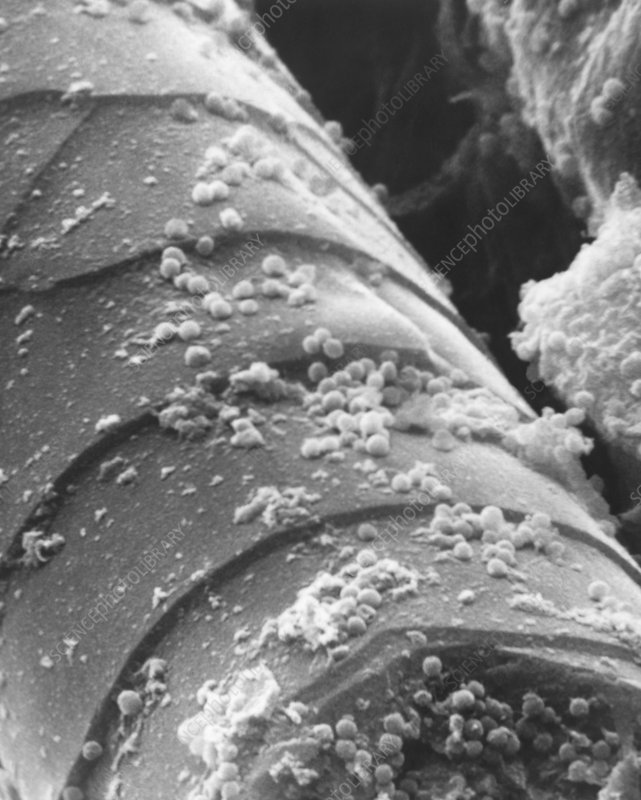 COVID-19 Bacteria on Hair